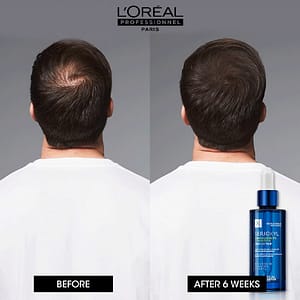 LOreal Professionnel Serioxyl Anti Hair Loss and Anti Hair Thinning Denser Hair Serum 90mL 02